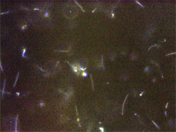 Non-motile Borrelia by Photo Micrograph