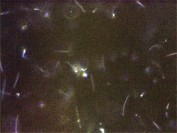 Results RNA | ACS 200 Achieves Complete Kill against Lyme Associated