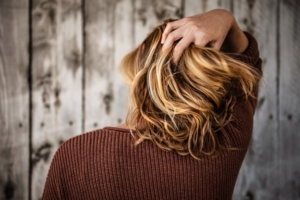 woman experiences hair loss after exposure to toxins